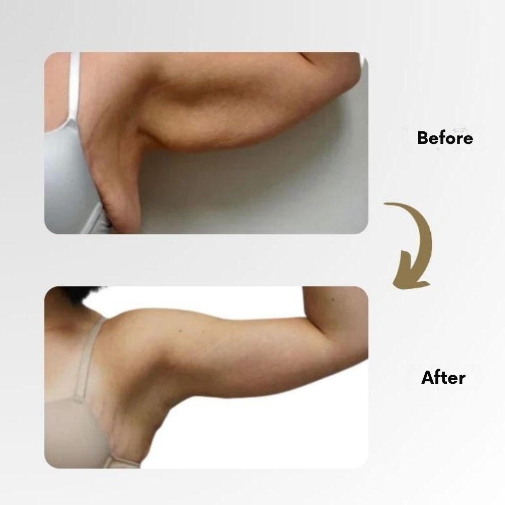 Magnetic wellness ring another view with before and after upper arm photos