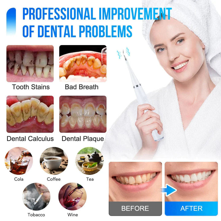 White scaler tool with tooth-problem close-ups and a before-and-after smile comparison.