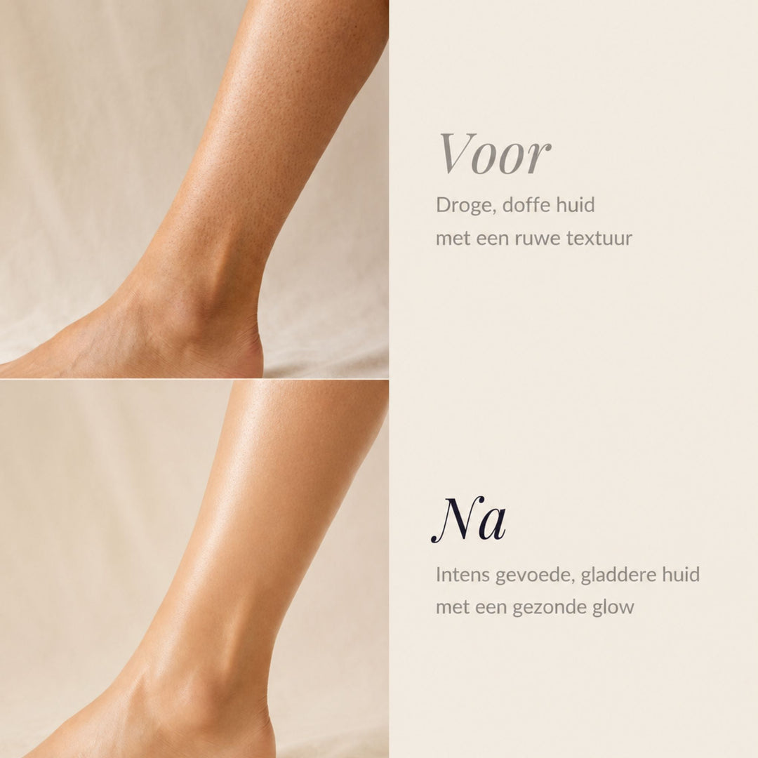 Before-and-after comparison of a bare lower leg and ankle, dry and matte on top, smoother and glowing below. 3