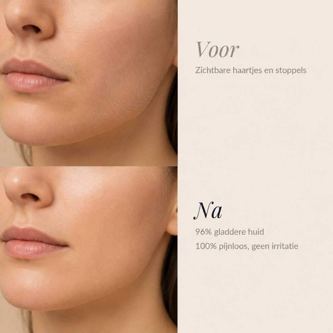 Before-and-after comparison of a woman's lower face, with visible fine hairs on top and smooth skin below.