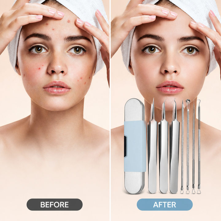 Before-and-after split showing a woman's blemished forehead and cheeks on the left and clearer skin on the right, with the tool set. 4
