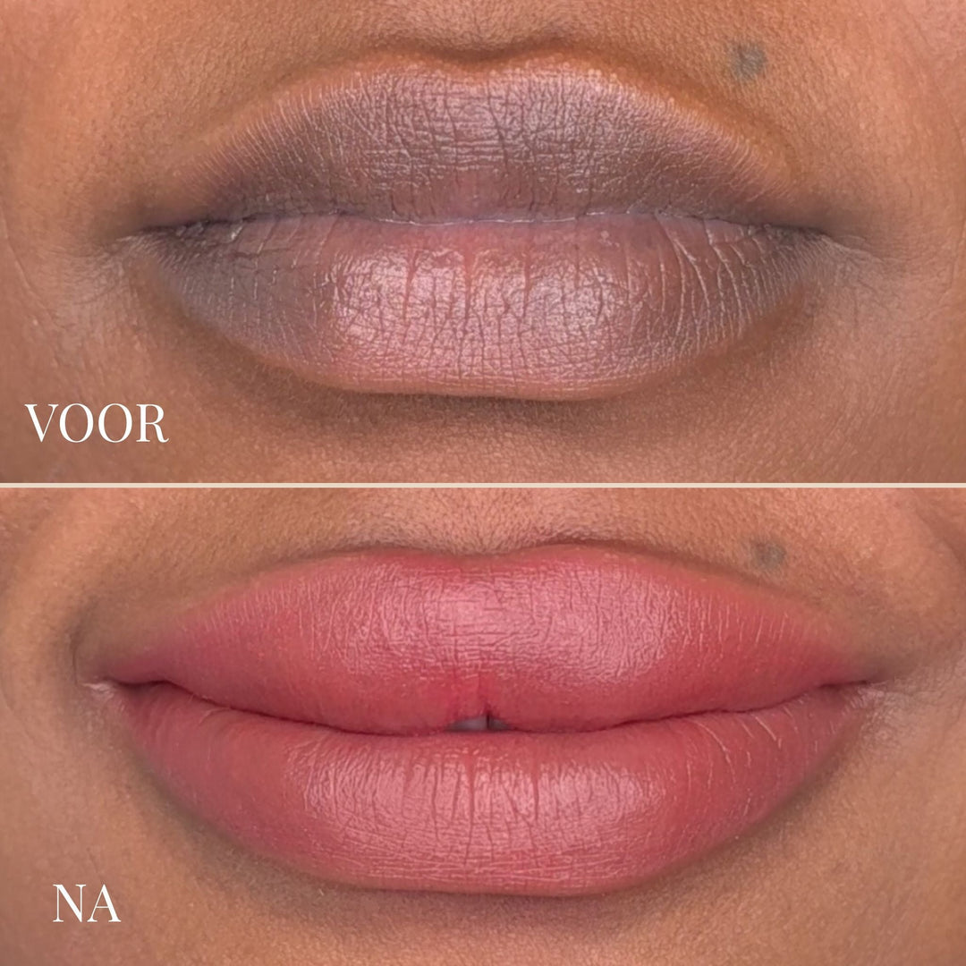 Before and after close-up of lips on deeper skin, from dull gray-brown to rosy pink.