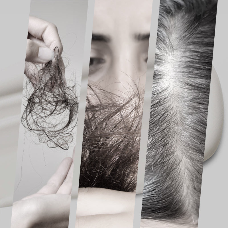 Three-panel collage of hair concerns: strands of fallen hair in a hand, frizzy damaged hair, and a scalp with graying roots. 3