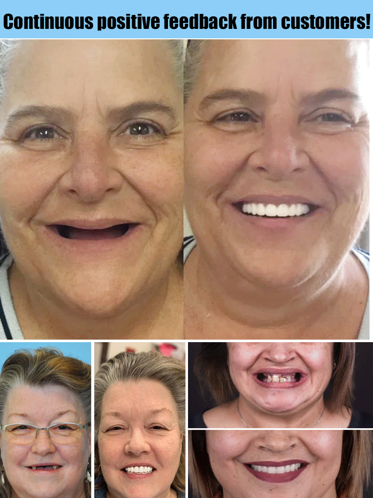 Before-and-after collage of smiling women, first without front teeth, then with a full white set of teeth.