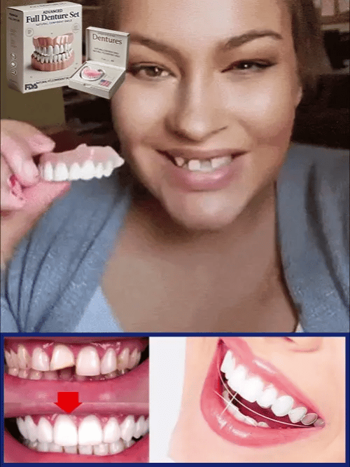 Woman with a missing front tooth holding up an upper denture, with a before-and-after view of a chipped tooth below.