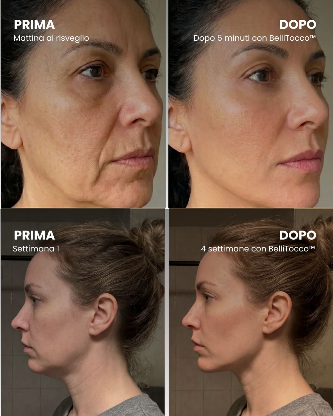 Before and after comparison grid of two women's faces in profile, one after five minutes and one after four weeks of use. 3