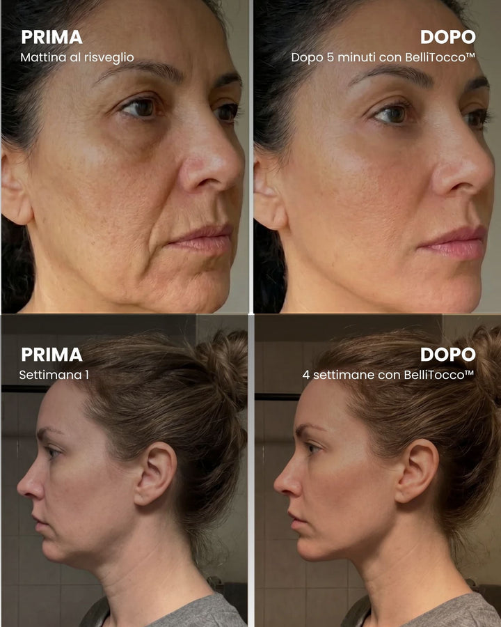 Before and after comparison grid of two women's faces in profile, one after five minutes and one after four weeks of use. 3