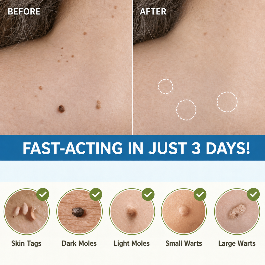 Gentle Skin Tag Removal Patches another view with before and after neck and back photos.