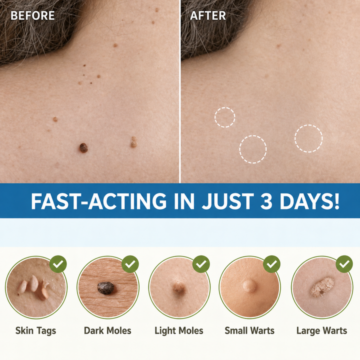 Before and after views of a neck and shoulder with moles gone, above circles showing skin tags, moles and warts the patches target.