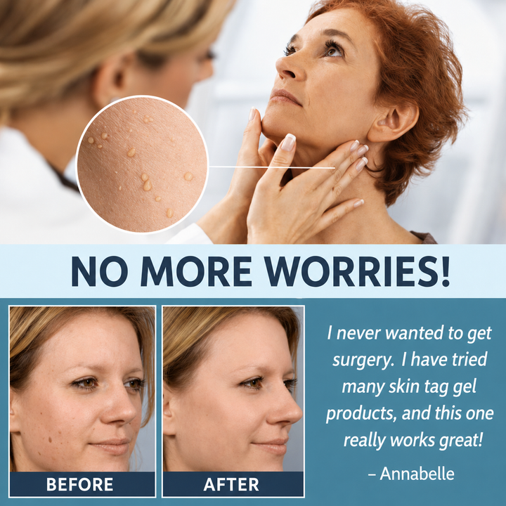 Dermatologist examining a woman's neck with a magnified skin inset, plus before and after face photos and a customer testimonial.