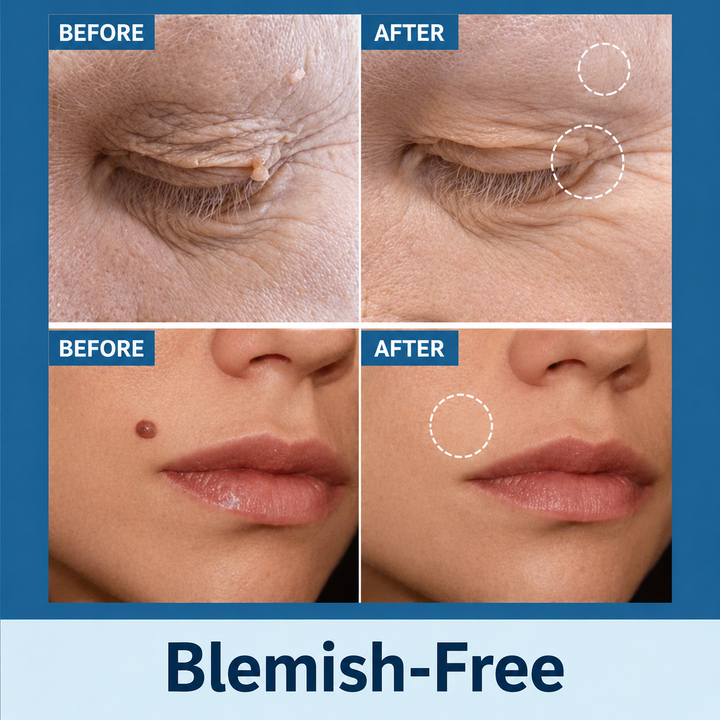 Gentle Skin Tag Removal Patches another view with four before and after close-ups.