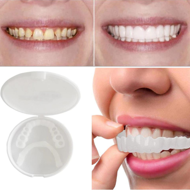 Snap-On Veneers for a Natural-Looking White Smile, Reusable and Glue-Free another view with the case and fitting steps
