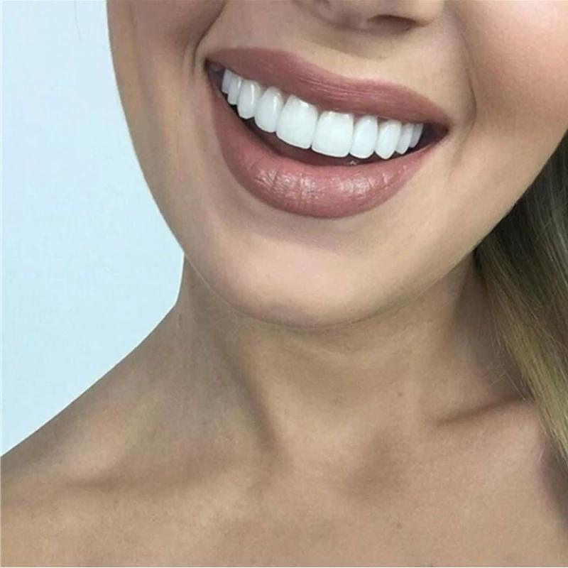 Close-up of a woman's smile showing bright, even white upper teeth, worn by a model, with nude lipstick and light hair. 3