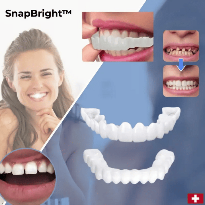 Snap-On Veneers for a Natural-Looking White Smile, Reusable and Glue-Free white plastic veneers