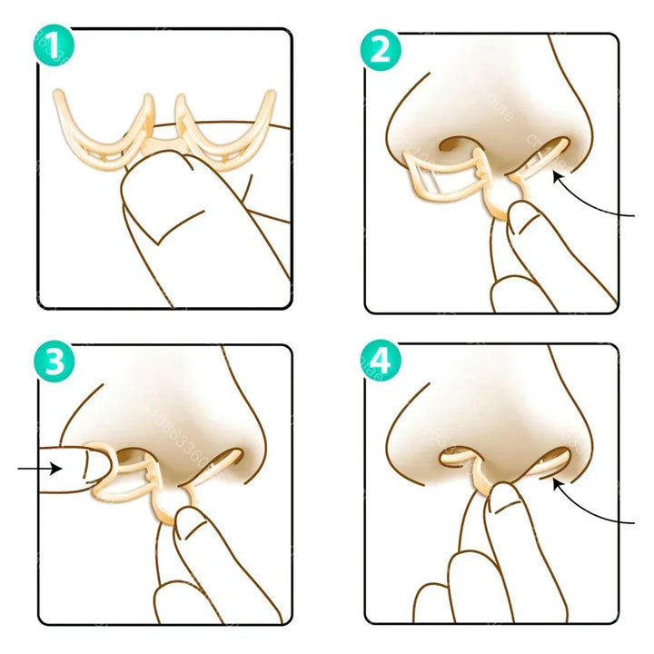 Comfortable Anti-Snoring Device - AirEase-1 piece-Nora Luxe
