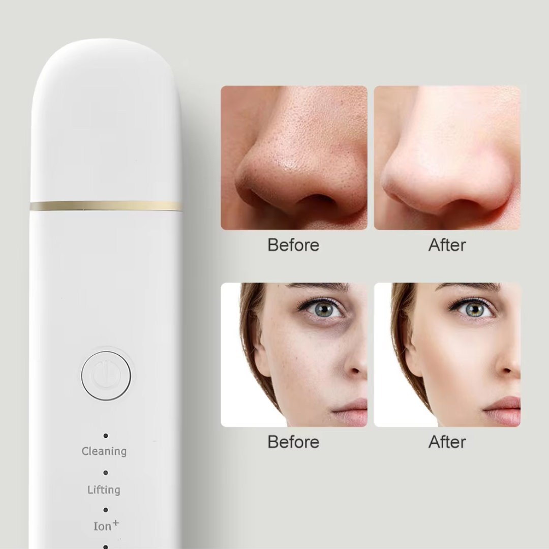 Deep Cleansing Skin Scrubber-White-Nora Luxe