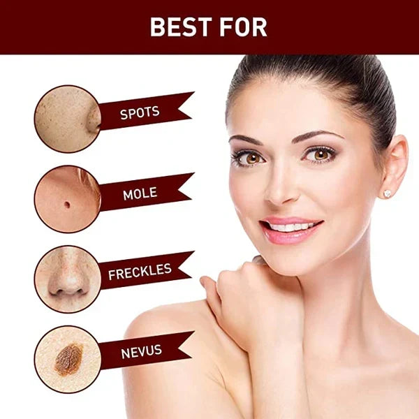 Another view showing a smiling woman beside close-ups of spots, a mole, freckles on a nose and a nevus.