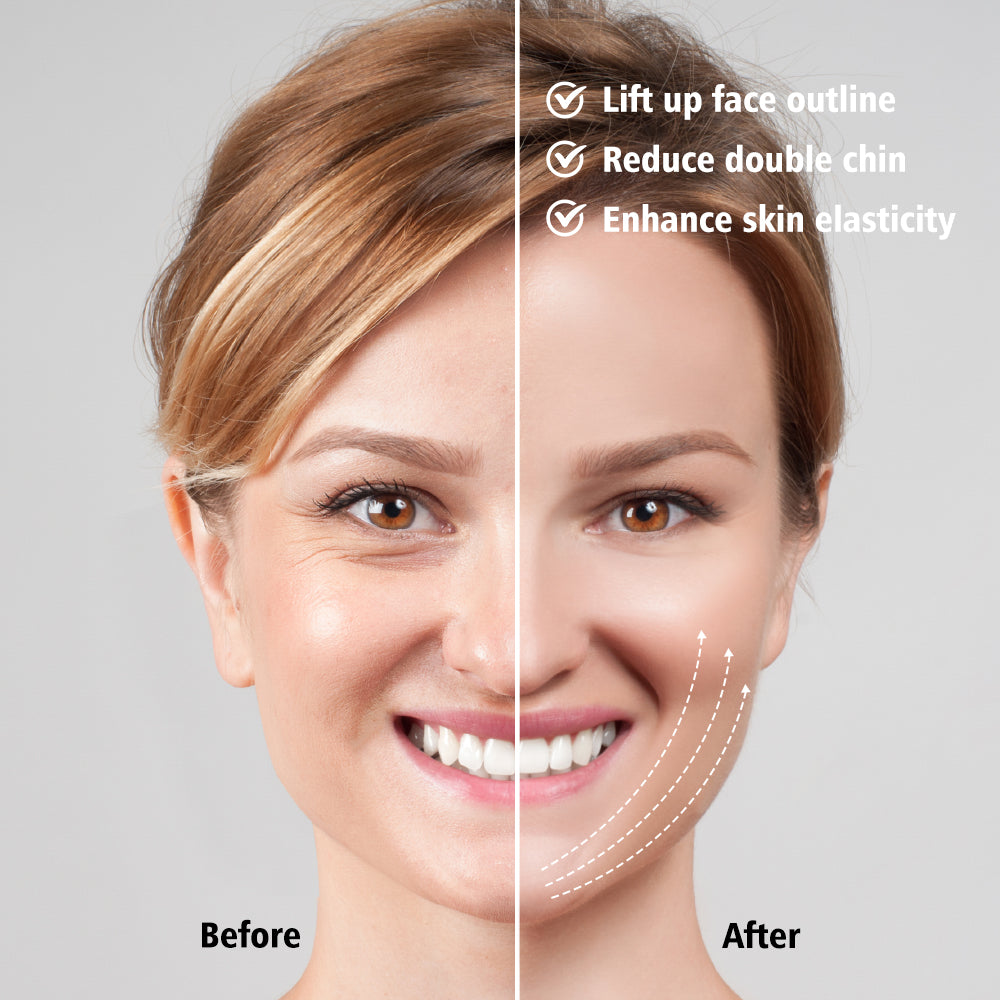 EMS FACE LIFT WITH LED THERAPY - SLIMMER FACE AND DOUBLE CHIN REMOVAL-White-Nora Luxe