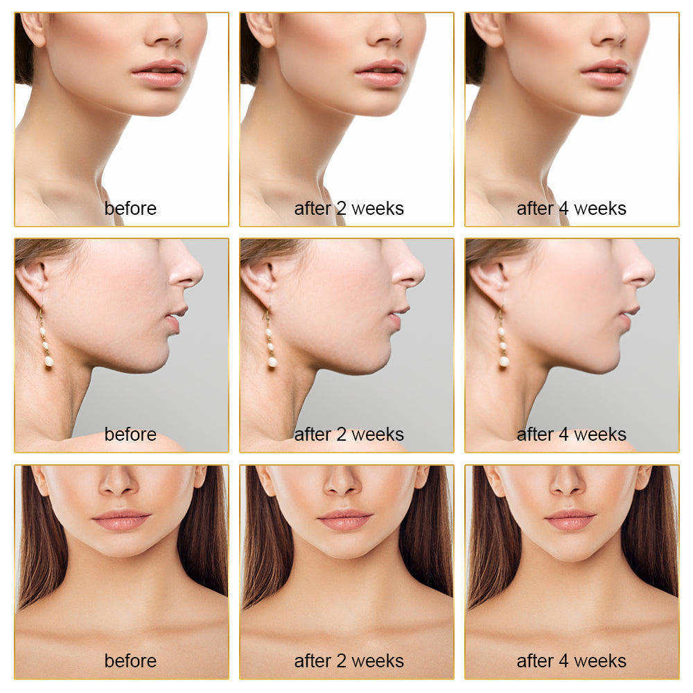 EMS FACE LIFT WITH LED THERAPY - SLIMMER FACE AND DOUBLE CHIN REMOVAL-White-Nora Luxe