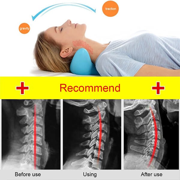Ergonomic Neck Massage Cushion without Power – NeckEase Stretch-Nora Luxe