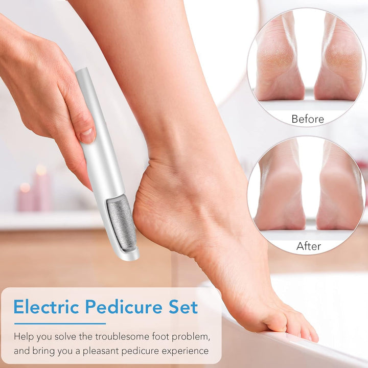 Hand pressing the remover's roller against a bare heel, with before and after heel comparison circles 2