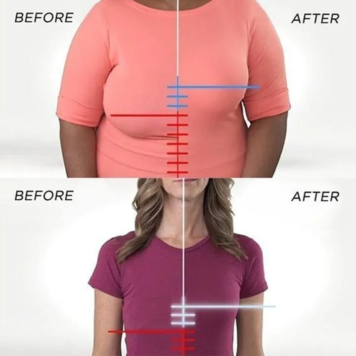 Before-and-after comparison of two women in T-shirts, showing the lifted bust profile.