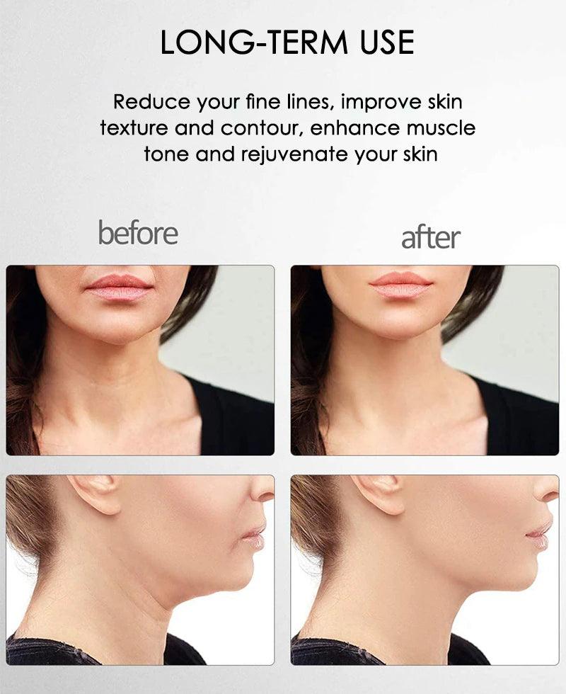 Microcurrent Facial Massager - FirmGlow-Nora Luxe