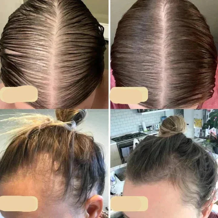 Natural Hair Growth Oil - PureGrowth-1 piece-Nora Luxe