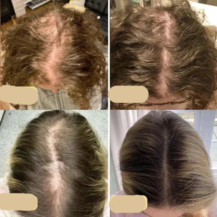Natural Hair Growth Oil - PureGrowth-1 piece-Nora Luxe