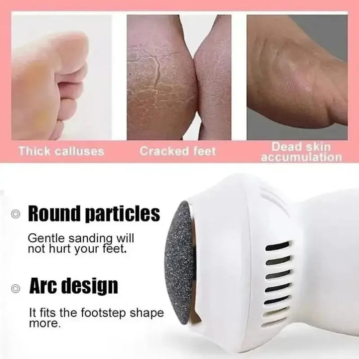 Professional Electric Callus Remover - SoleCare-Nora Luxe