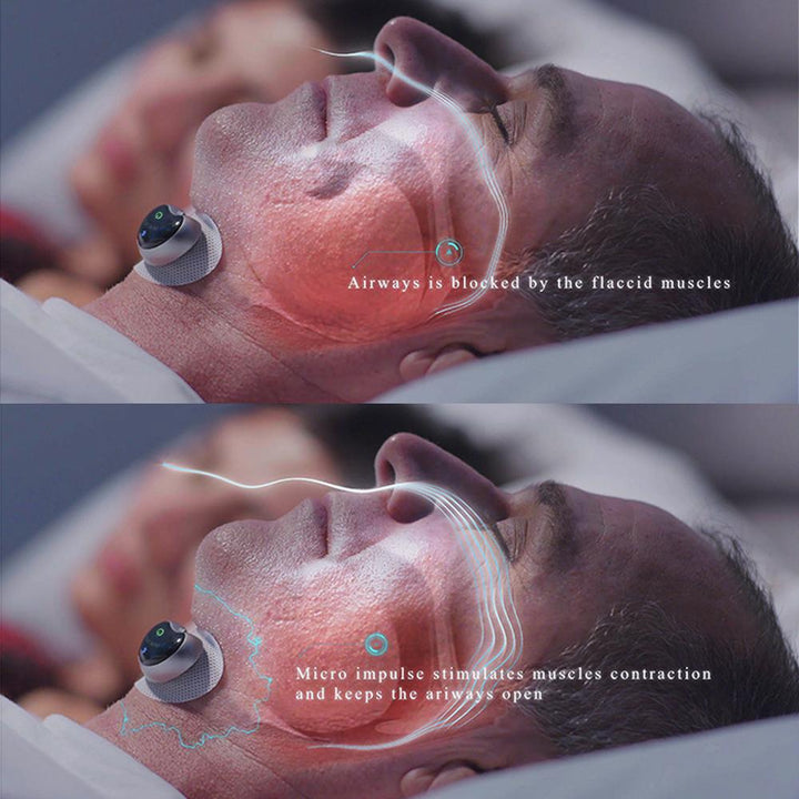 Slim Anti-Snoring Device - SleepEase-Nora Luxe